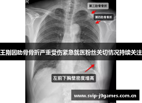 王刚因肋骨骨折严重受伤紧急就医粉丝关切情况持续关注 王刚因肋骨骨折严重受伤紧急就医粉丝关切情况持续关注